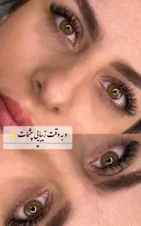 کاشت مژه فقط و فقط امروز و فردا ۴۵۰