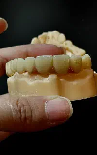 دندانسازی لابراتوار