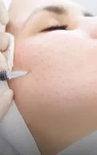 تزریق مزوژل و بوتاکس توسط پزشک با 30 درصد تخفیف