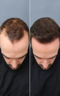 تار هاتو افزایش بده