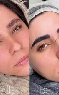 ریمو تک جلسه ایی
