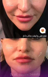 جشنواره ویژه مطب دکتر علی دیانی