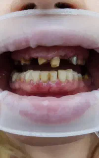 لابراتوار دندانپزشکی (سازنده انواع روکش 1800ت)