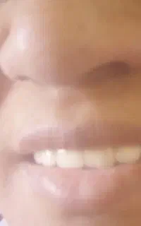 خدمات دندانپزشکی و روکش دندان