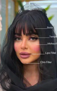تخفیف ویژه پایان فصل/ژل،بوتاکس