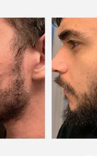 تار نو در چهرت