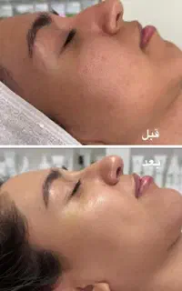 فیشال تخصصی
