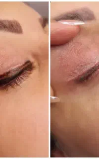 ریموو خط چشم و ابرو