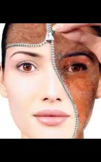 بوتاکس ،مزوتراپی ،پی ار پی ،میکرونیدلینگ