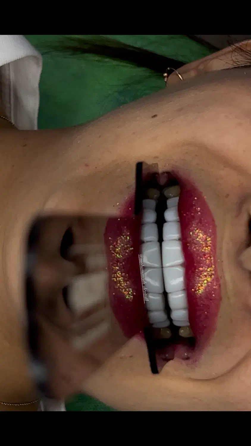 کامپوزیت زیبایی|خدمات آرایشگری و زیبایی|فومن, |دیوار