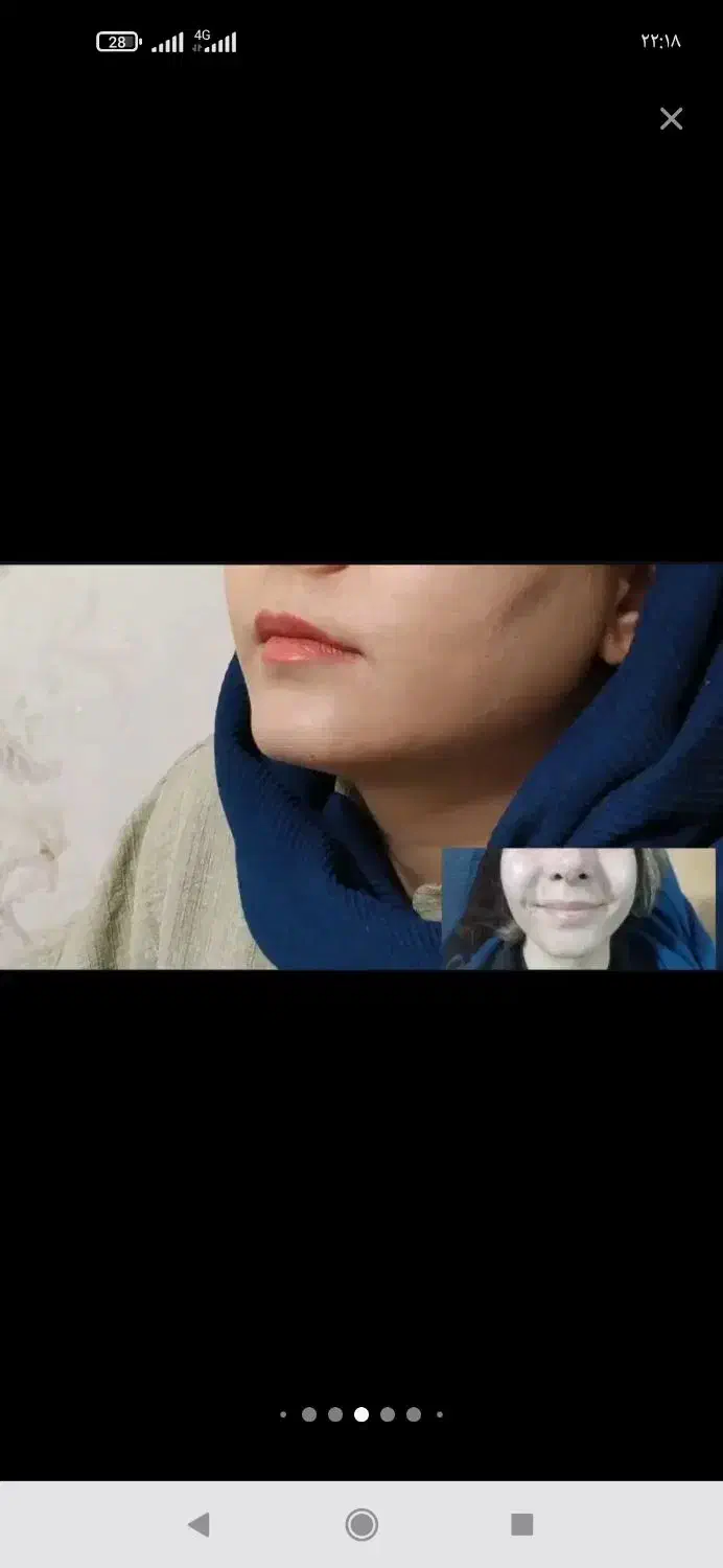 تخفیف بوتاکس و ژل|خدمات آرایشگری و زیبایی|دورود, |دیوار