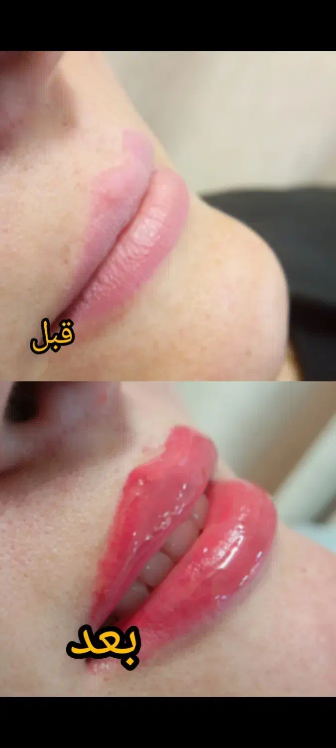 فیبروز.میکروپیگمنتیشن وشیدینگ لب|خدمات آرایشگری و زیبایی|شیراز, ملاصدرا|دیوار