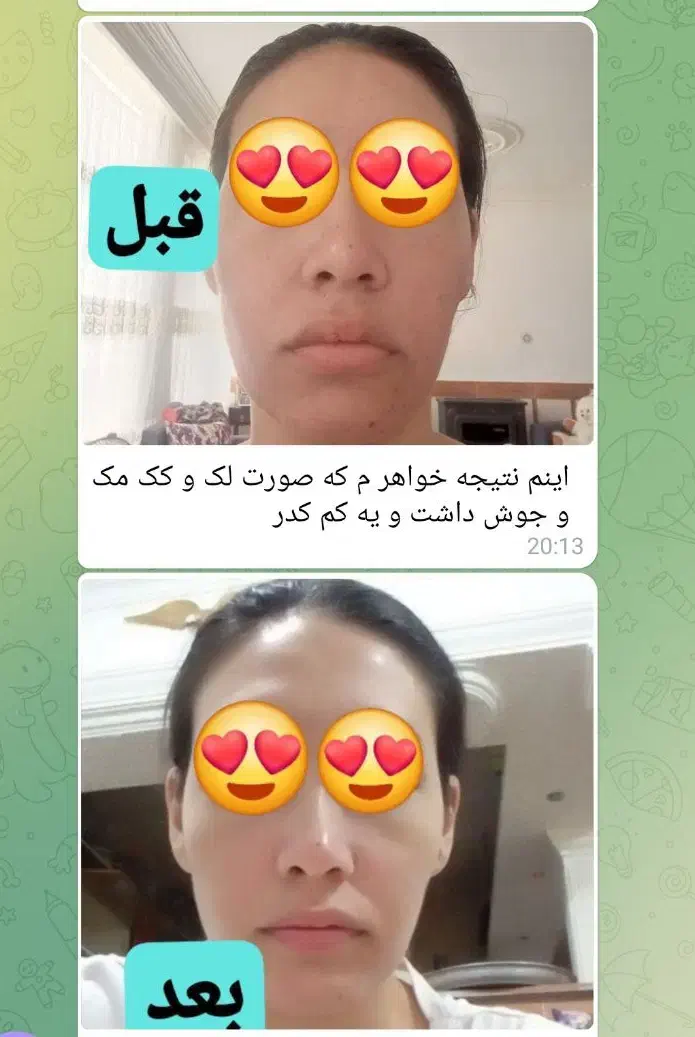 پوست کره ای|خدمات آرایشگری و زیبایی|ارومیه, |دیوار