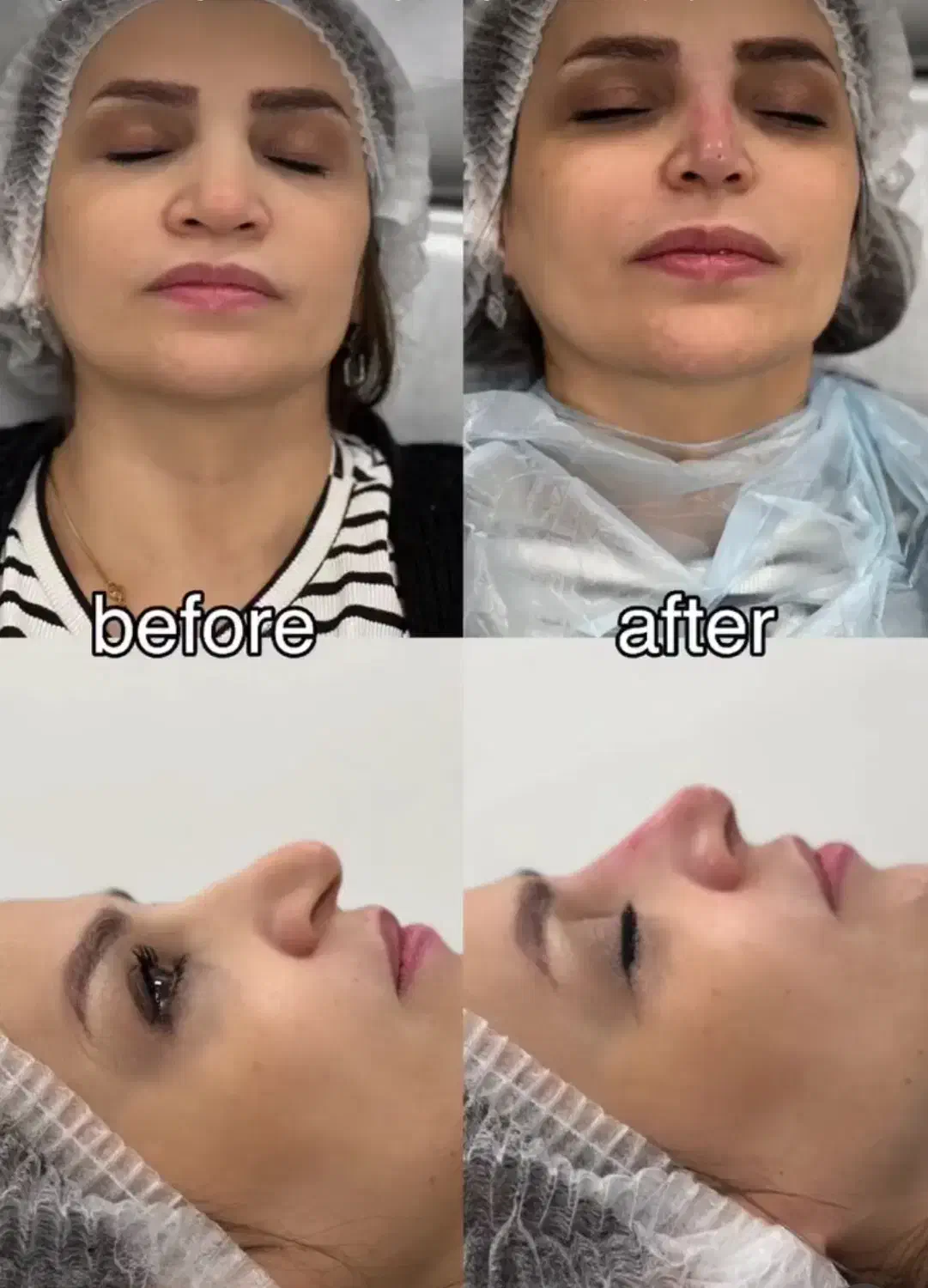 خدمات پوست، مو ، زیبایی|خدمات آرایشگری و زیبایی|تهران, امانیه|دیوار