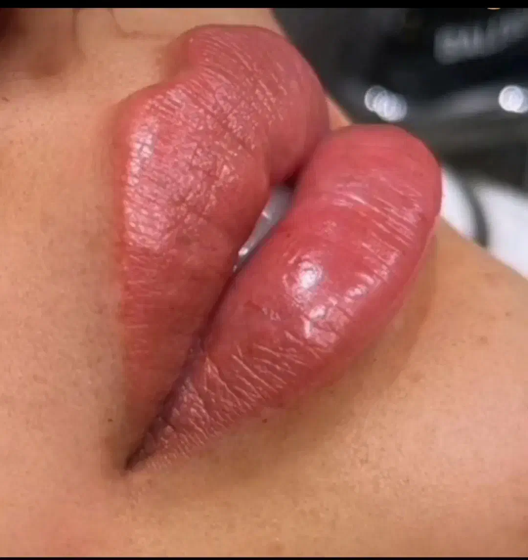 انواع خدمات ژل بوتاکس انزیم تخفیف ویژه|خدمات آرایشگری و زیبایی|کوهدشت, |دیوار