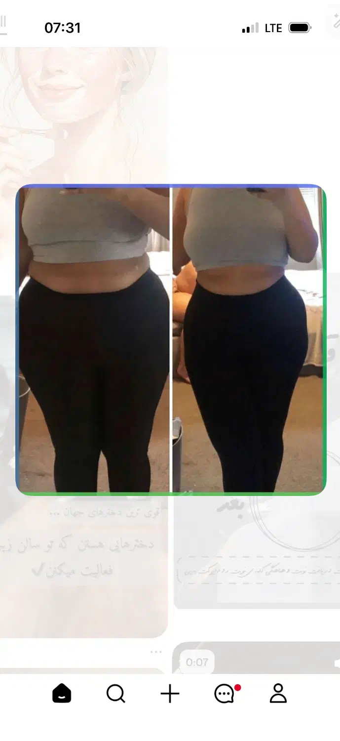 تخفیف یلدایی لیزر و لاغری با تخفیف لیزر بیا|خدمات آرایشگری و زیبایی|ارومیه, |دیوار