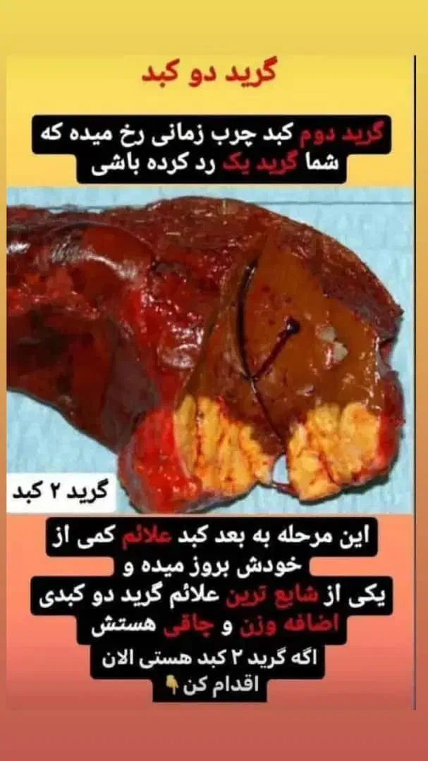وایتکس کبد|خوردنی و آشامیدنی|شیراز, امام حسین|دیوار