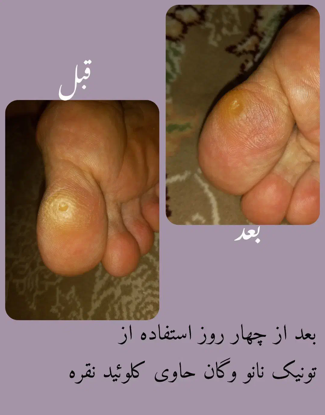 نانو کلوئید نقره رو همه جامعه همراهت داشته باش|مواد شوینده و دستمال کاغذی|یزد, |دیوار