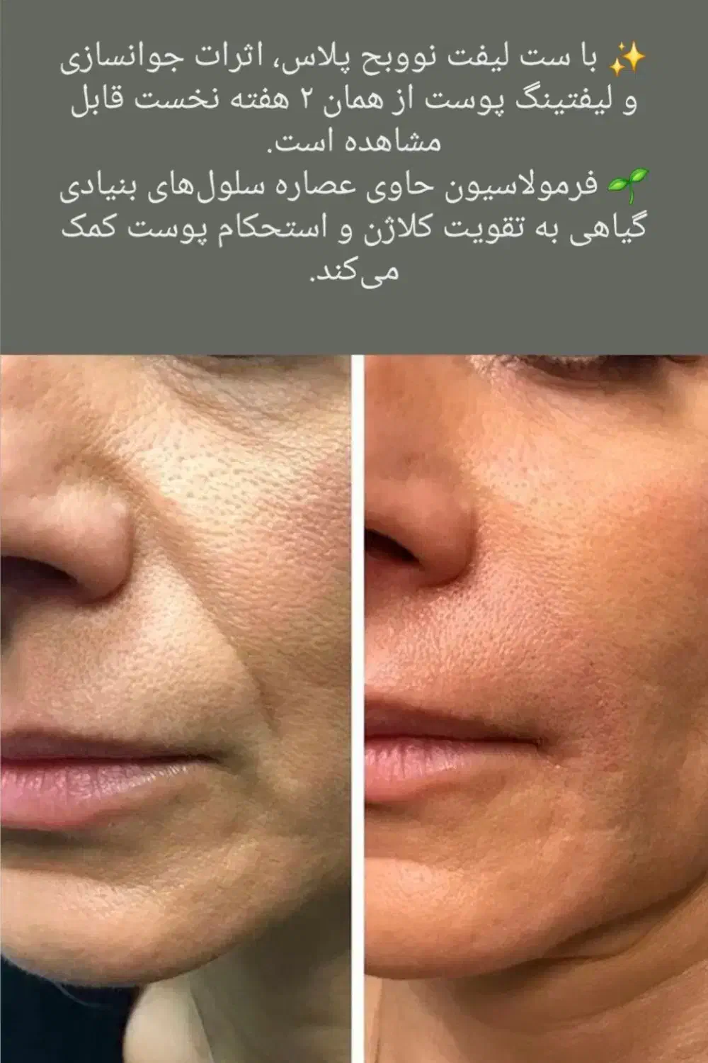 پوستت لایق یه تغییر خاصه|خدمات آرایشگری و زیبایی|شاندیز, |دیوار