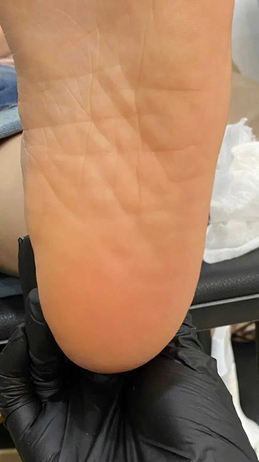 آموزش صفرتاصد کفسابی درمانی|خدمات آموزشی|رشت, گلزاران|دیوار