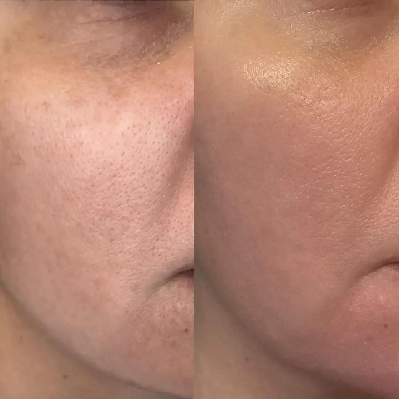 دستگاه هفت کاره فیشیال به همراه ماسک ال ای دی|آرایشی، بهداشتی، درمانی|پرند, فاز ۰|دیوار