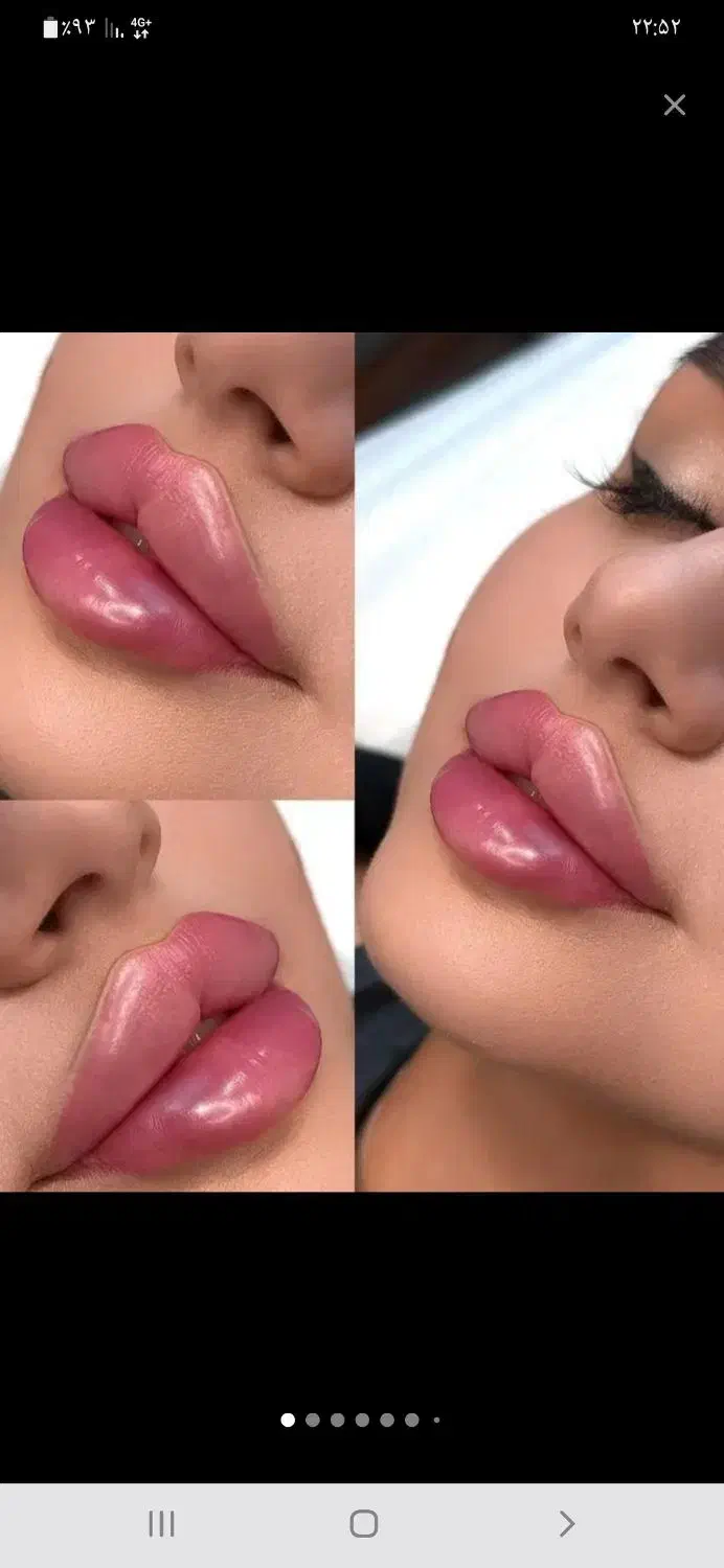 پوست و مو و لیزر|خدمات آرایشگری و زیبایی|اردبیل, |دیوار