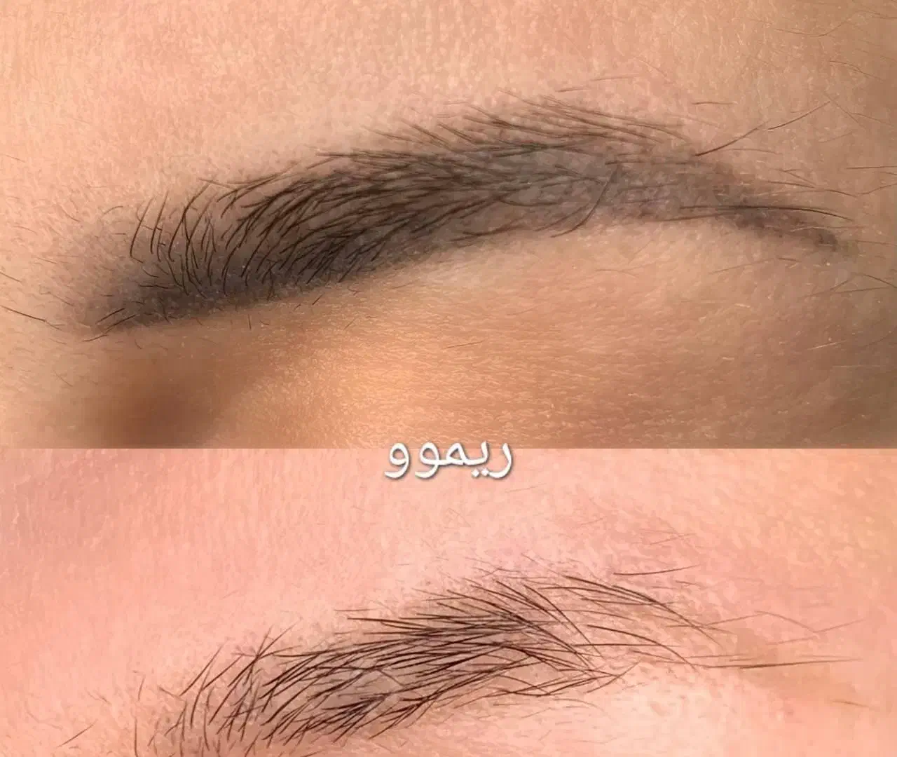 ریمو ابرو فقط تو یک دقیقه بدون زخم دوره نقاهت|خدمات آرایشگری و زیبایی|کاشان, زیدی|دیوار