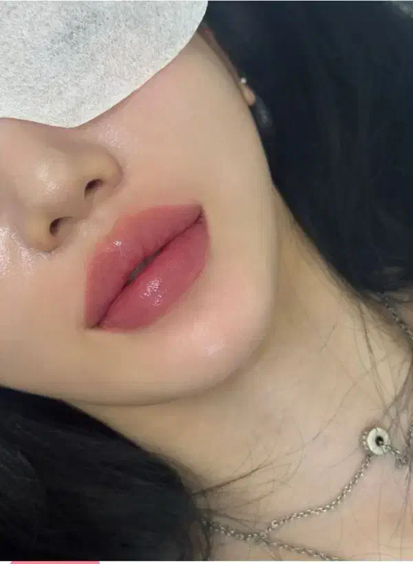 ژل و بوتاکس صورت|خدمات آرایشگری و زیبایی|فولادشهر, مسکن مهر فولادشهر|دیوار