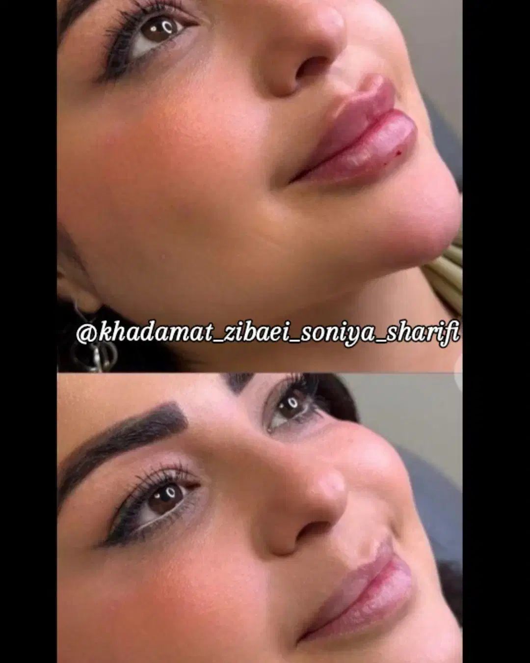 تخفیف ویژه ژل و بوتاکس تا یک هفته|خدمات آرایشگری و زیبایی|اهواز, منبع اب|دیوار