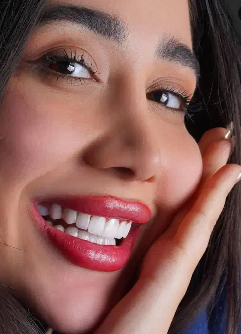 ایمپلنت اقساطی دندانپزشکی لمینیت|خدمات آرایشگری و زیبایی|کیش, |دیوار