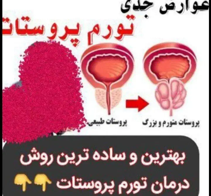 پروستات وسردی بدن|آرایشی، بهداشتی، درمانی|شیراز, مهدی‌آباد|دیوار