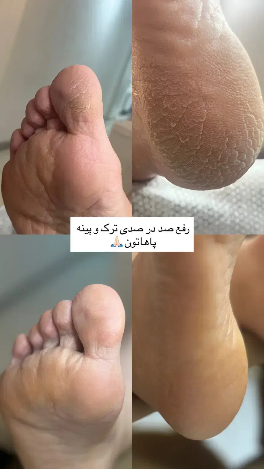 ۱ نفر ظرفیت برای کفسابی یا ژلیش یکشنبه|خدمات آرایشگری و زیبایی|رشت, گلباغ نماز|دیوار