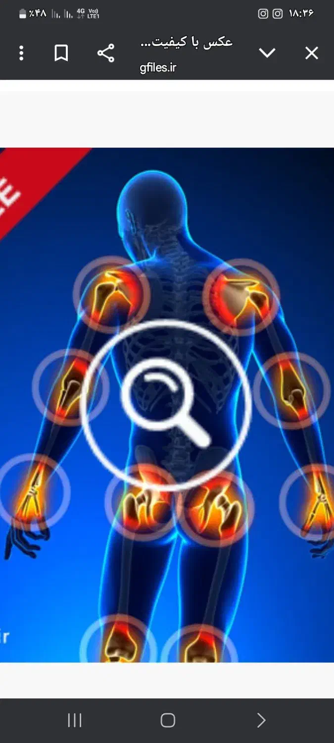 بهبود دردمفاصل و آرترز و دیسک|خدمات آرایشگری و زیبایی|گنبد کاووس, |دیوار