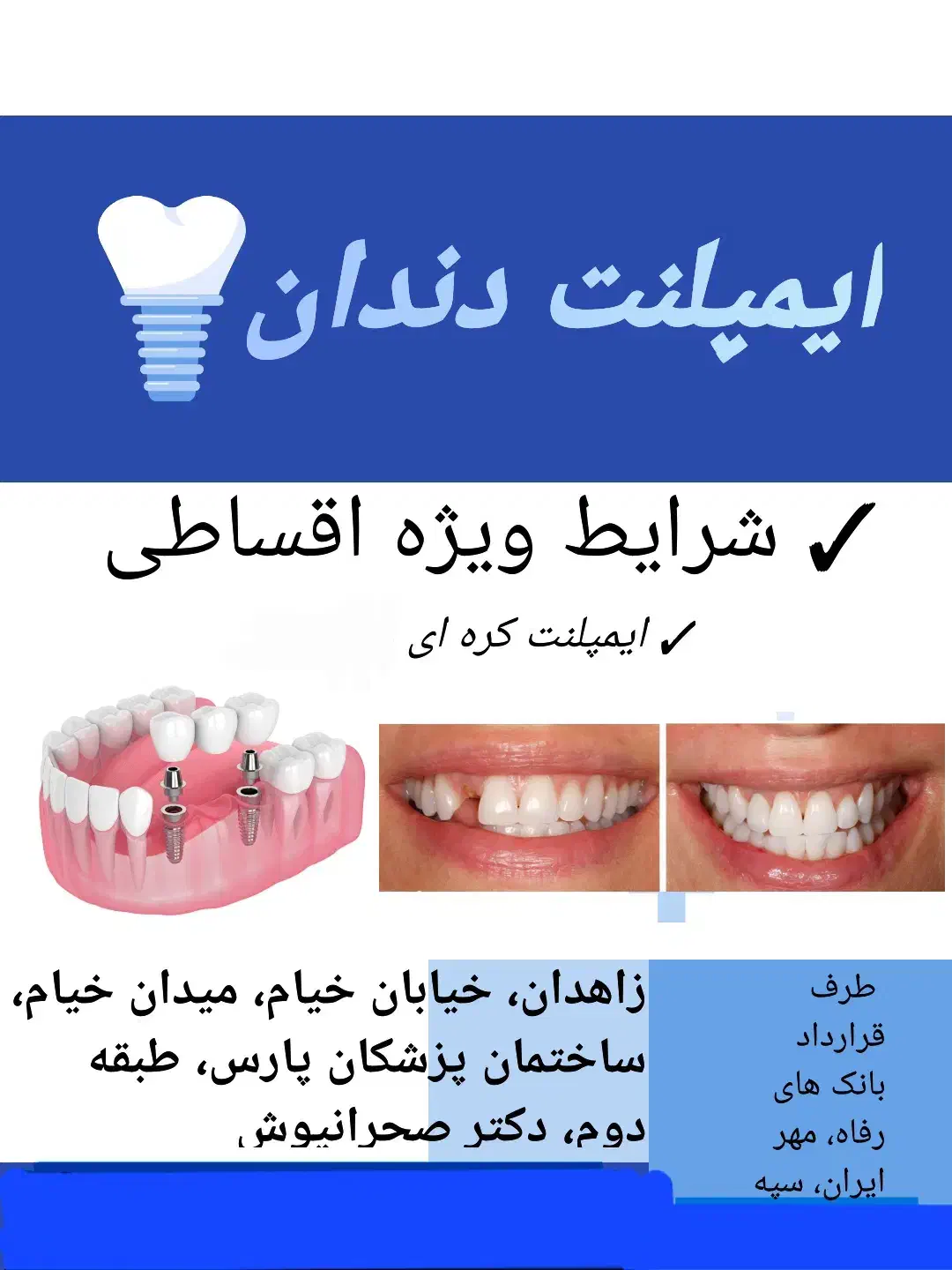 ایمپلنت دندانی|خدمات آرایشگری و زیبایی|زاهدان, |دیوار