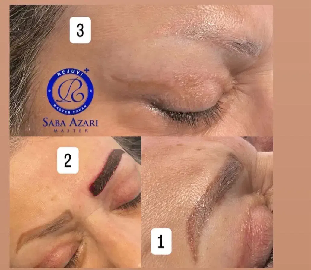 مدل رایگان ریموو تاتو قدیمی|خدمات آرایشگری و زیبایی|قشم, |دیوار