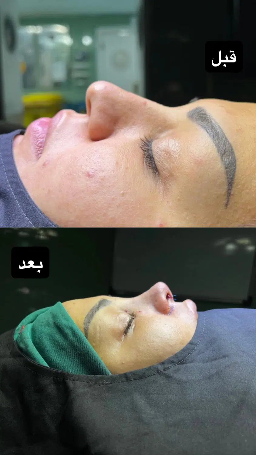 جراحی بینی با فوق تخصص پلاستیک فقط ۵۵میلیون|خدمات زیبایی و سلامت|تهران, قبا|دیوار