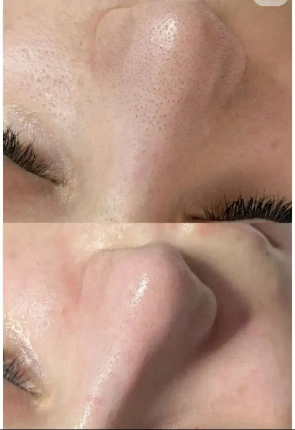 خدمات و اموزش فشیال (پاکسازی صورت)|خدمات آرایشگری و زیبایی|کرمانشاه, |دیوار