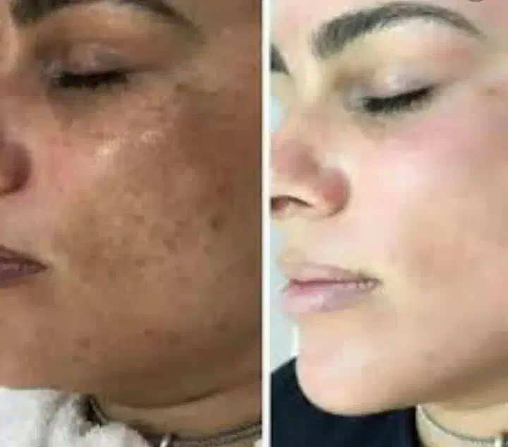 کرم معجزه vip اصلی سفید کننده دائم پوست و لکه بر|آرایشی، بهداشتی، درمانی|اسدآباد, |دیوار