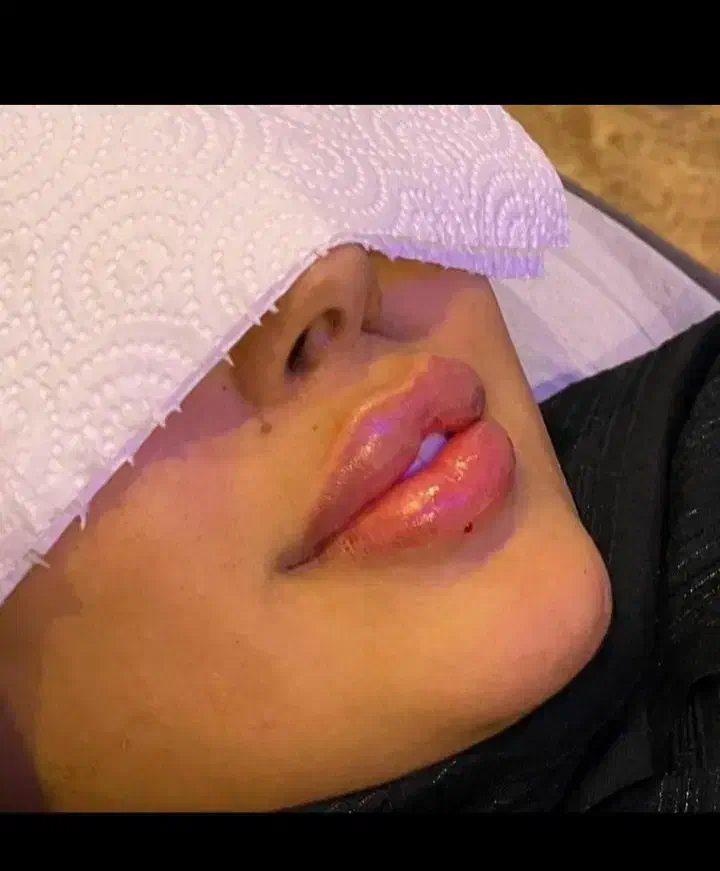 آموزش ژل و بوتاکس نیدلینگ|خدمات آموزشی|رفسنجان, |دیوار