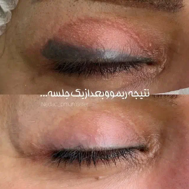 جشنواره پاییزی ریمو ابرو و خط چشم در یک جلسه|آرایشی، بهداشتی، درمانی|تهران, دهم فروردین|دیوار