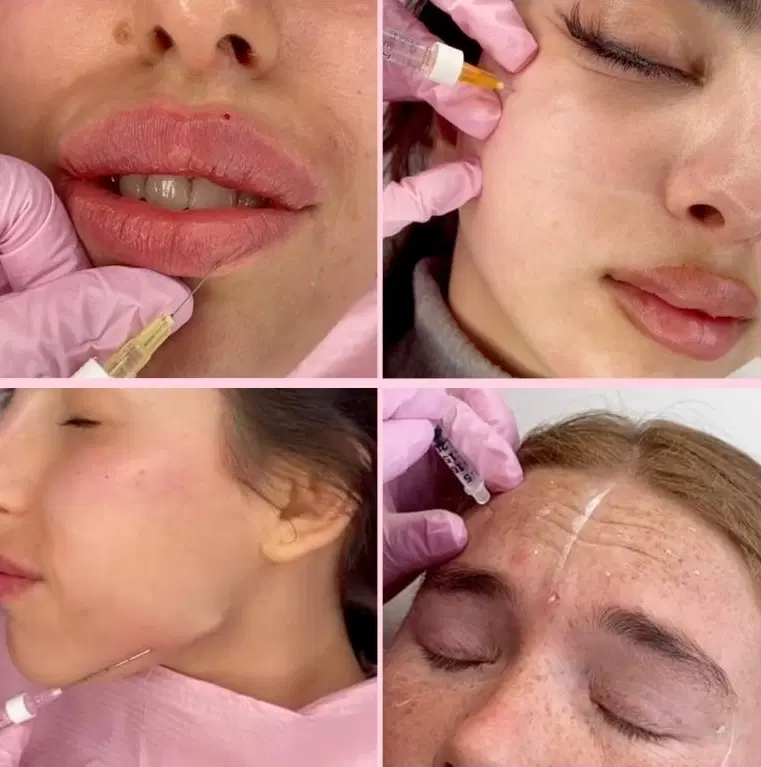فیلر ،بوتاکس و کانتورینگ چهره و prp و خدمات فیشیال|خدمات زیبایی و سلامت|مشهد, کوه سنگی|دیوار