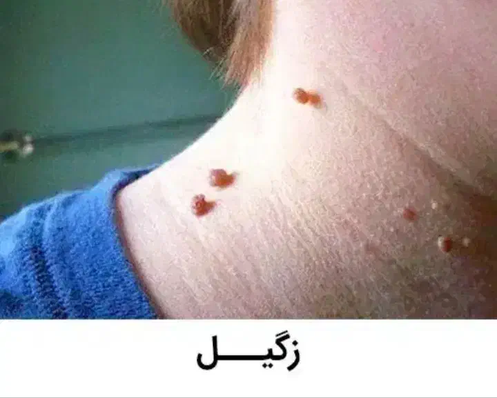 برداشت خال زگیل میخچه ختنه در مطب|خدمات آرایشگری و زیبایی|قم, هفت تیر|دیوار