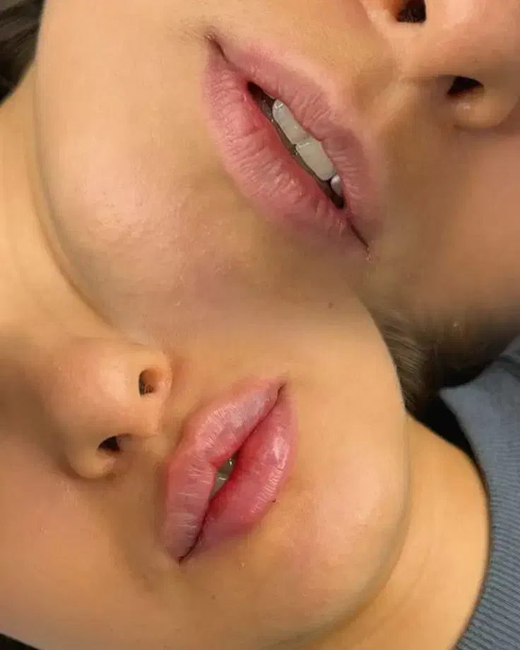 جشنواره آموزشی فیلر نخ بوتاکس زیر نظر دکتر...|خدمات آموزشی|تهران, قلهک|دیوار