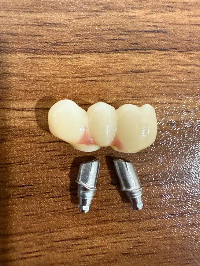 اموزش حضوری دورهای طراحی دیجیتال دندانسازی اگزوکد|خدمات آموزشی|شیراز, زرگری|دیوار