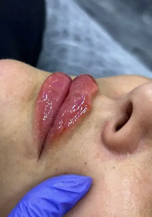 آف ژل بوتاکس مناسبت روز زن|خدمات آرایشگری و زیبایی|ایذه, |دیوار