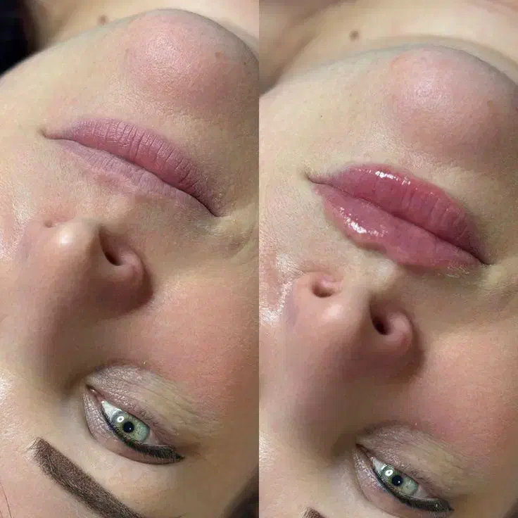 مطب زیبایی پوست مو لیزر الکساندرایت|خدمات آرایشگری و زیبایی|مشکیندشت, |دیوار