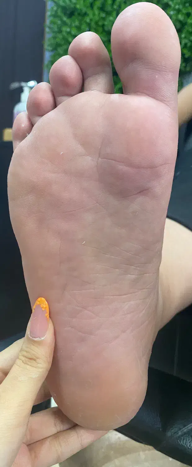 -رفع ترک و پینه پا با تکنیک تخصصی|خدمات آرایشگری و زیبایی|قائم‌شهر, |دیوار