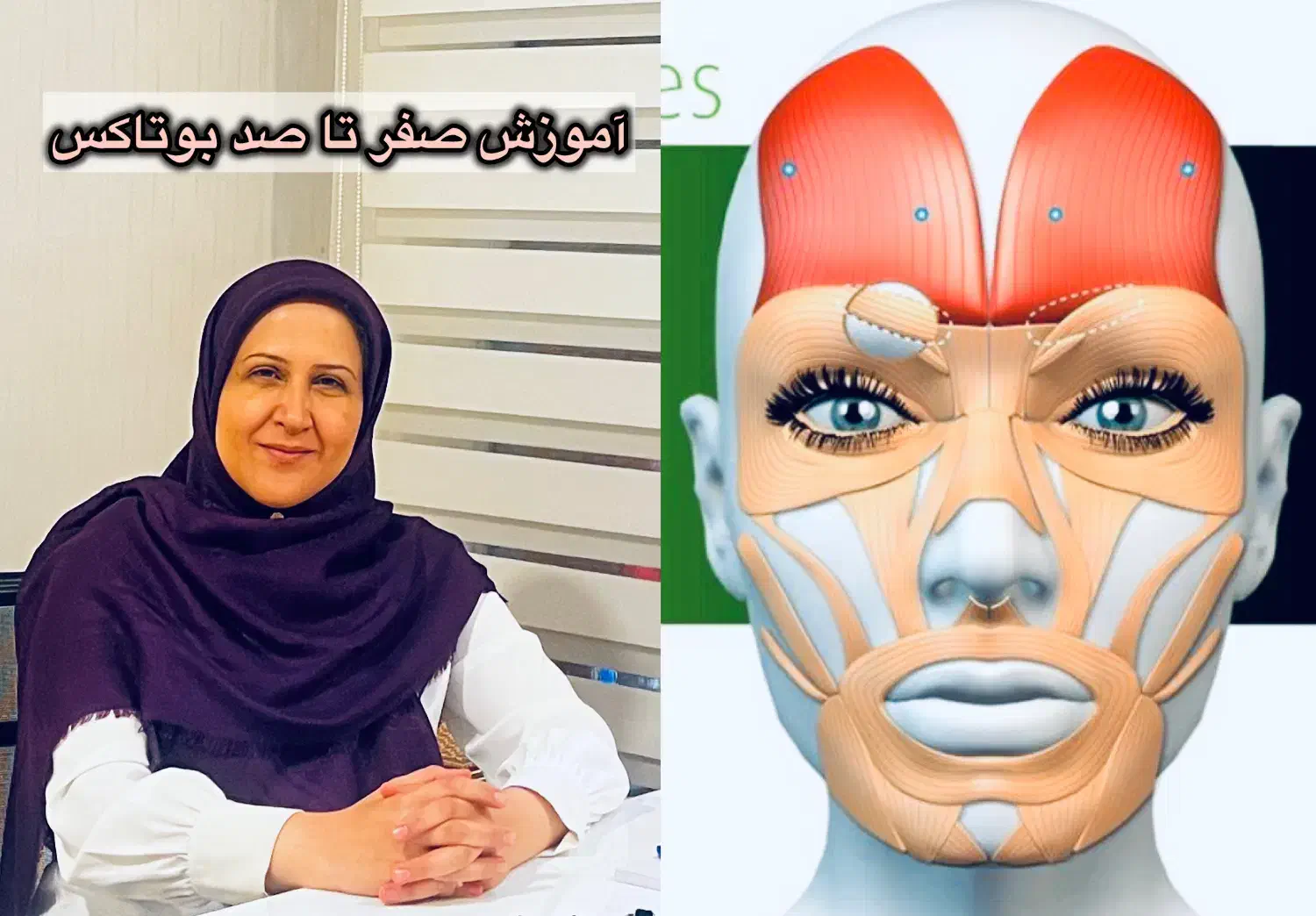 آموزش بوتاکس|خدمات آموزشی|تهران, کاشانک|دیوار
