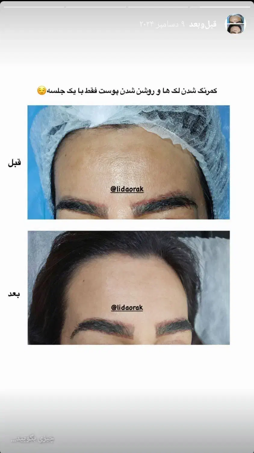 آموزش پی آر پی وپی آر اف|خدمات آموزشی|اصفهان, خانه اصفهان|دیوار