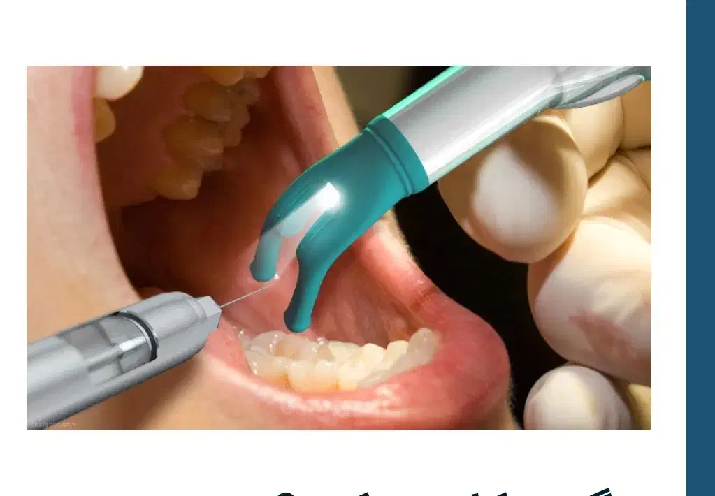 کلینیک دندانپزشکی  تزریق بیحسی بدون درد|آرایشی، بهداشتی، درمانی|کرمان, |دیوار